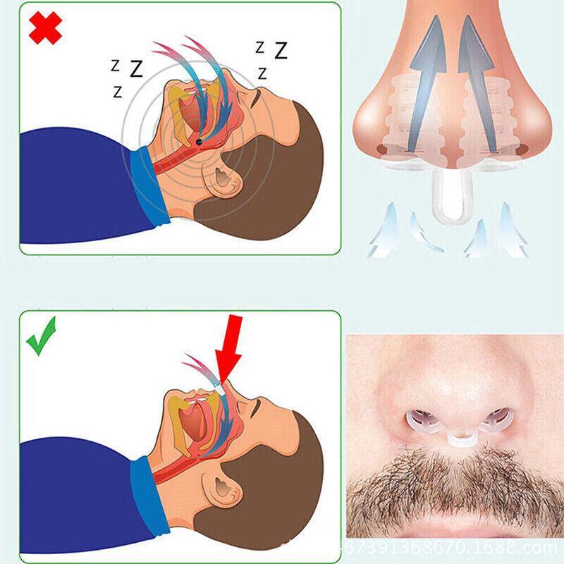PE Nasal Vent Clip for Comfortable Breathing Airflow Support Accessory view 4