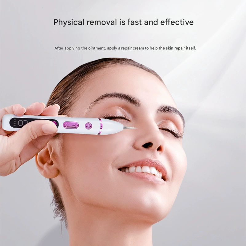 Professional Electric Mole & Dark Spot Remover Pen - Advanced Plasma Ion view 2