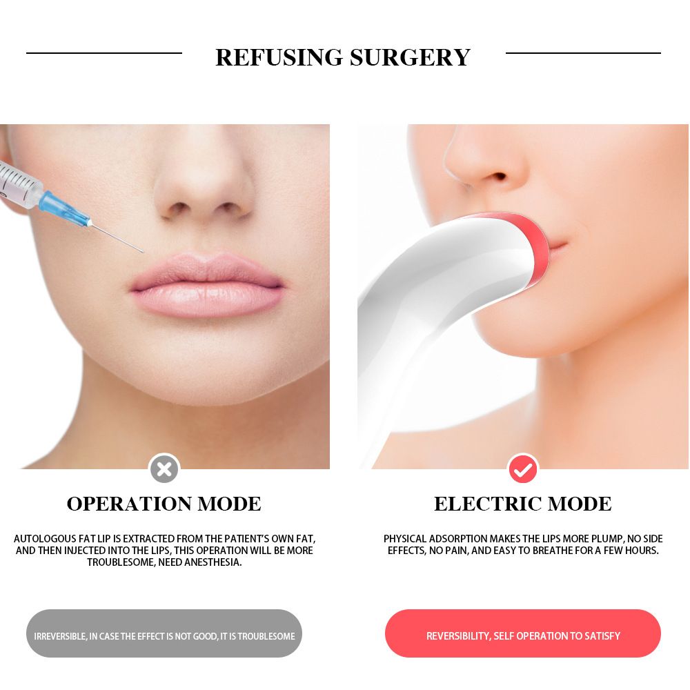 Lip Plumper Tool, Electric Lip Plumper, Lip Plumper Device, Lip Enhancer view 5